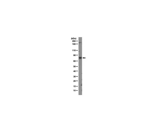62-8369-33　Anti-MDM2, clone 3G9; 100 μg　04-1530