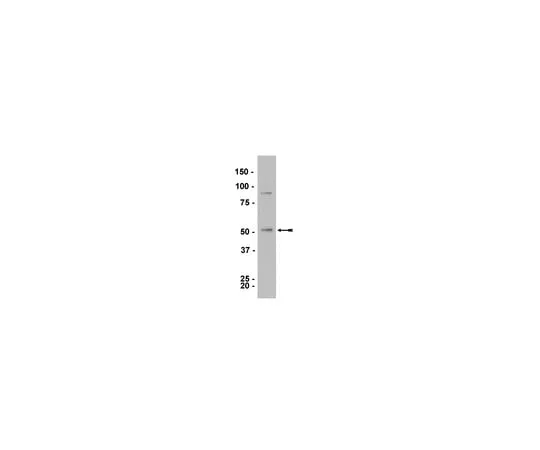 62-8373-33　Anti-LKB1, clone 5c10; 100 μg　05-832