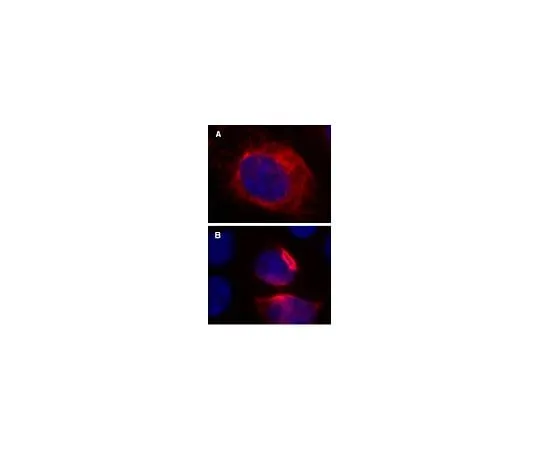 62-8394-36　LentiBrite(TM) RFP-Vimentin Lentiviral Biosensor　17-10153