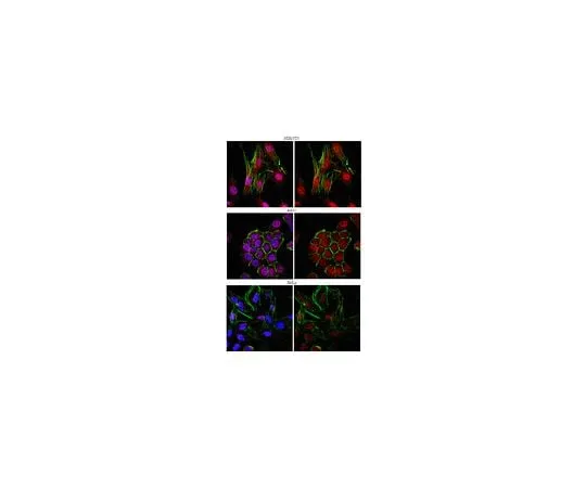 62-8459-97　Anti-Smad4/DPC4; 100 μg　ABE21