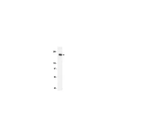 62-8371-04　Anti-erbB-3/HER-3, clone 2F12; 200 μg　05-390