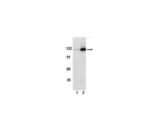62-8386-75　anti-phospho-FAK (Tyr861); 100 μL　07-832