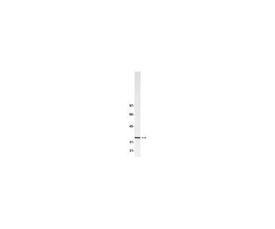 62-8383-89　Anti-Blys/TALL-1/BAFF/THANK; 100 μg　07-167