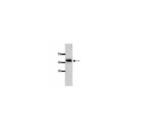 62-8454-31　Anti-UGT2B7 (UDP-Glycosyltransferase 2B family, polypeptide 7); 50 μL　AB10343