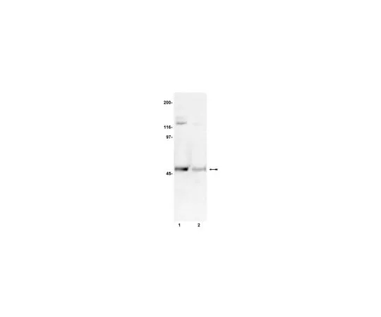 62-8371-62　Anti-phospho-CaM Kinase II, α subunit, (Thr286), clone 22B1; 100 μg　05-533