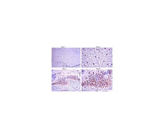 62-8454-80　Anti-Glycine Receptor alpha3 subunit ; 100 μg　AB15014