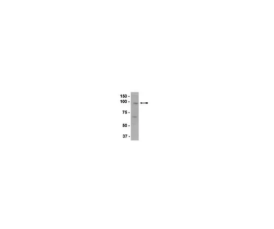62-8386-25　Anti-EZH2; 200 μL　07-689