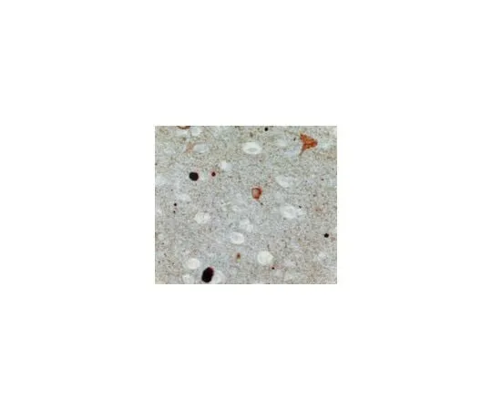 62-8449-03　Anti-Synuclein, alpha; 20 μg　AB5038P