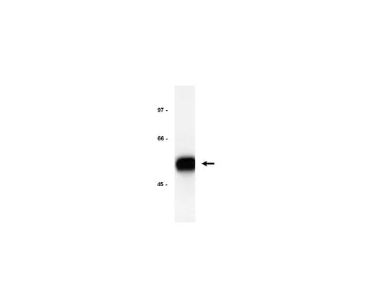 62-8370-95　Anti-E2F-1, clones KH20 and KH95; 200 μg　05-379