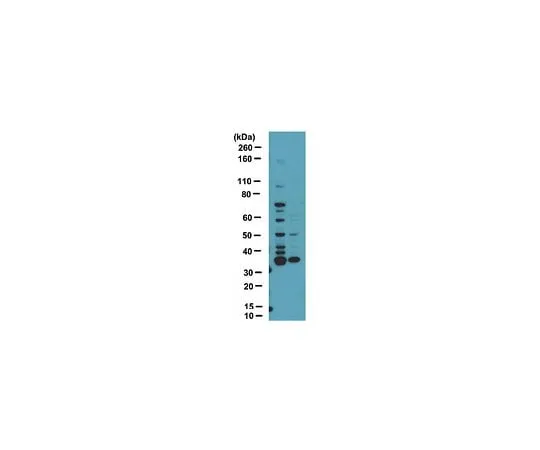 62-8389-96　Anti-dimethyl-Arginine, asymmetric (ASYM25); 100 μL　09-814