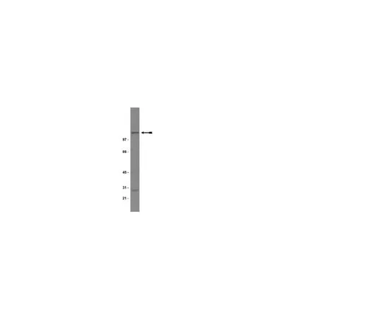62-8371-14　Anti-NR1, CT; 200 μg　05-432