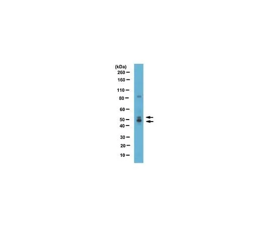 62-8463-52　Anti-Nuclear factor 1/C　ABE1387