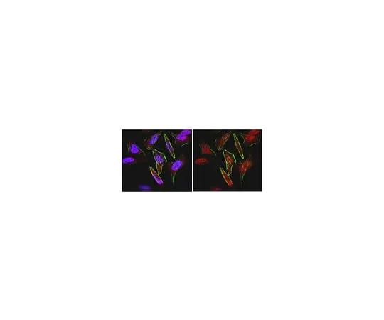 62-8459-65　Anti-FOXC1; 100 μg　ABD71