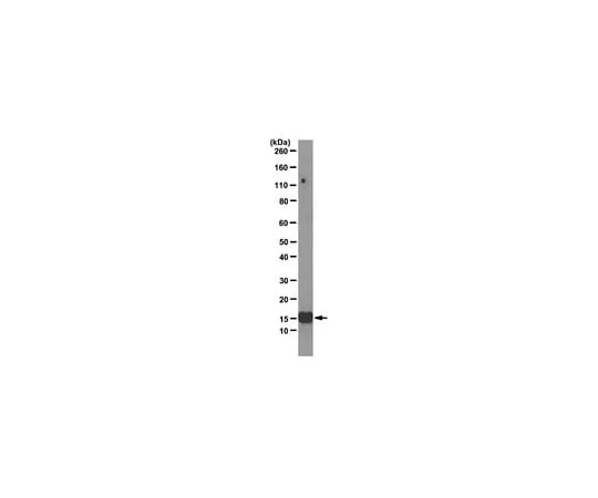 62-8369-58　Anti-Interleukin-2 (IL-2), clone 3F9; 100 μg　04-1584