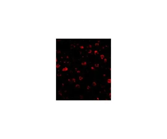 62-8462-41　Anti-SATB1　ABE602