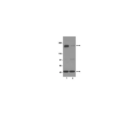 62-8384-82　Anti-phospho-NR2B (Ser1303); 200 μg　07-398