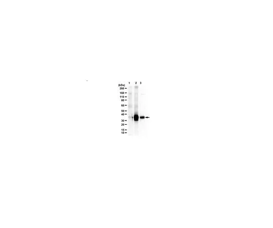 62-8468-15　Anti-C9ORF72/C9RANT (poly-PA)　ABN1356