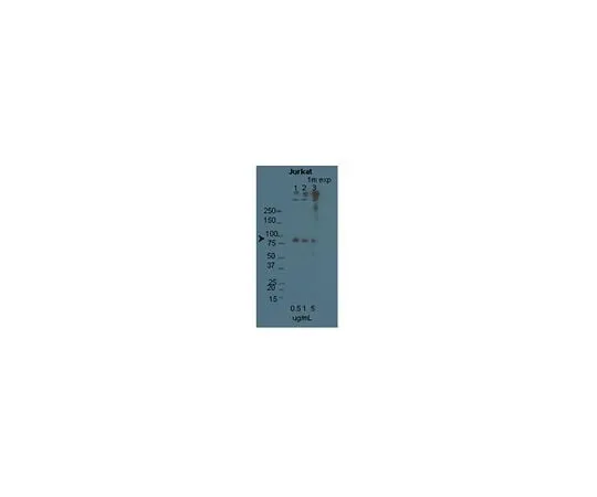 62-8453-80　Anti-STIM1; 100 μg　AB9870