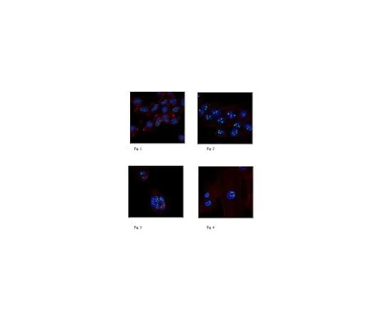 62-8462-86　Anti-Ligand-dep***ent nuclear receptor-interacting factor 1　ABE1008
