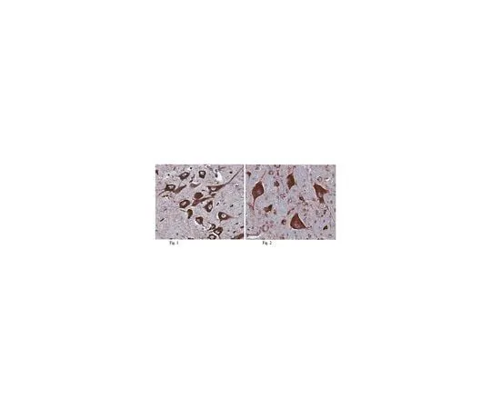 62-8466-51　Anti-MANF　ABN306
