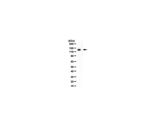62-8464-14　Anti-DBC1 Antibody　ABE1950