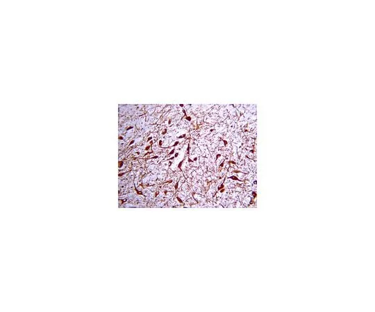 62-8444-33　Anti-Tyrosine Hydroxylase; 100 μL　AB152
