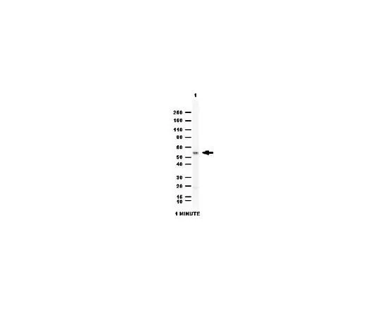 62-8459-35　Anti-Aldehyde dehydrogenase 1 (ALDH1A1); 100 μg　ABD12