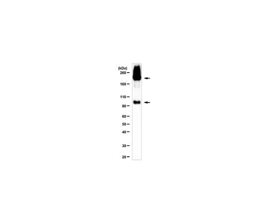62-8384-24　Anti-mGluR2　07-261-I