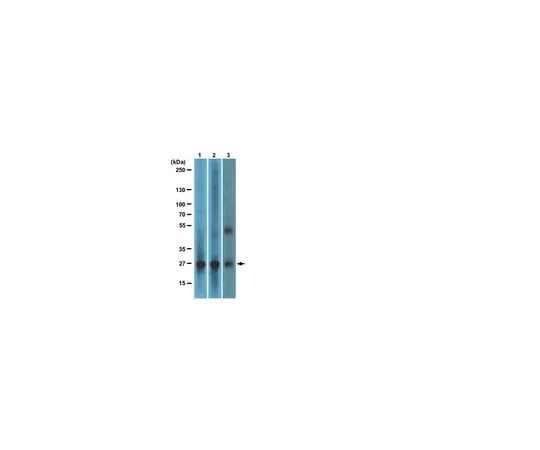 62-8367-86　anti-RalB, clone 25; 100 μg　04-037