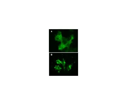 62-8394-50　LentiBrite(TM) GFP-β-actin Lentiviral Biosensor　17-10204