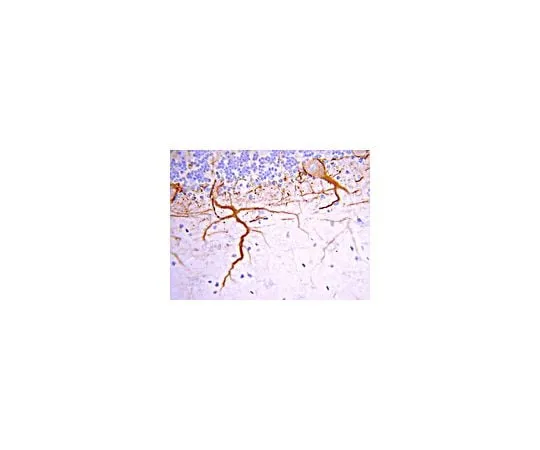 62-8446-19　Anti-Neurofilament M (145 kDa), C-terminus; 50 μL　AB1987