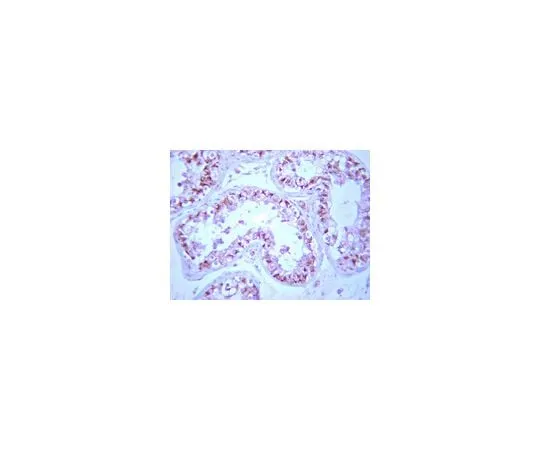 62-8387-21　Anti-PP2A, B β subunit;; 100 μg　07-1219