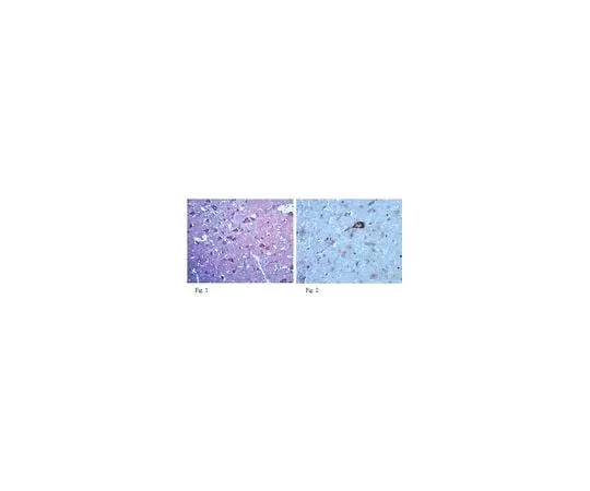 62-8465-72　Anti-Neurexin3; 100 μg　ABN96