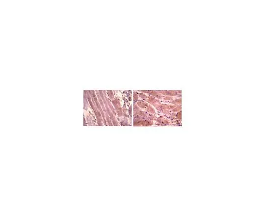 62-8446-47　Anti-Atrial Natriuretic Polypetide, alpha; 100 μg　AB2232
