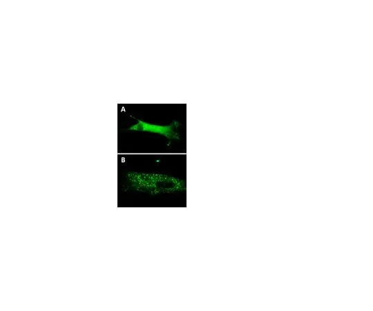 62-8394-61　LentiBrite(TM) GFP-p62 Lentiviral Biosensor　17-10224
