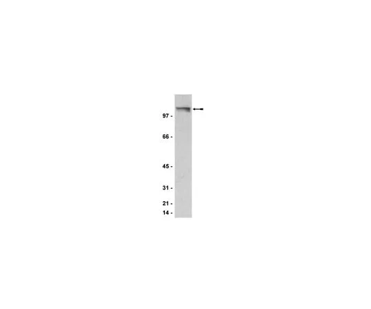 62-8372-56　Anti-PML, clone 36.1-104; 200 μg　05-718