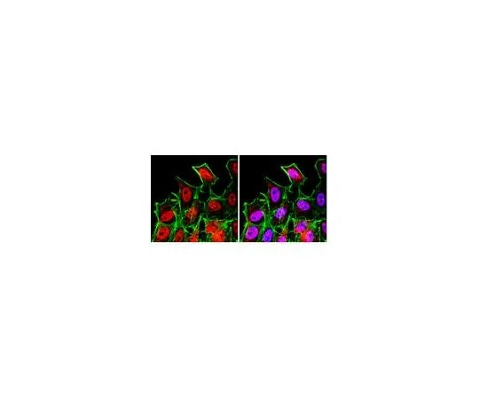 62-8388-28　Anti-FOXO3A; 100 μg　07-1719