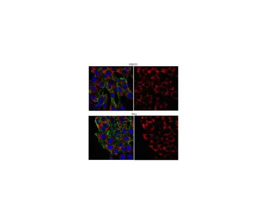 62-8460-10　Anti-PABPC1/C3; 100 μg　ABE40