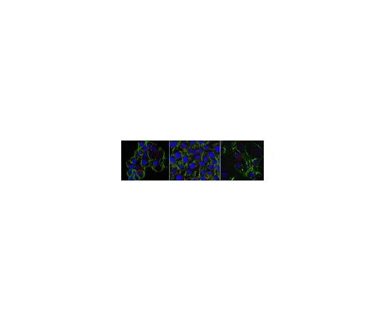 62-8526-99　Anti-beta-Actin Antibody, clone 4C2　MABT825