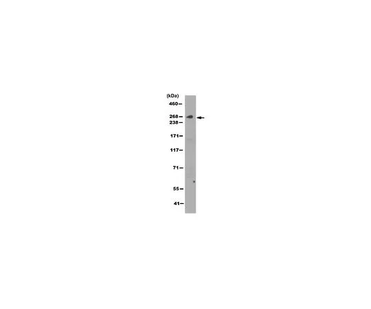 62-8520-83　Anti-IP3R3 Antibody, clone 6G12.1　MABN1544