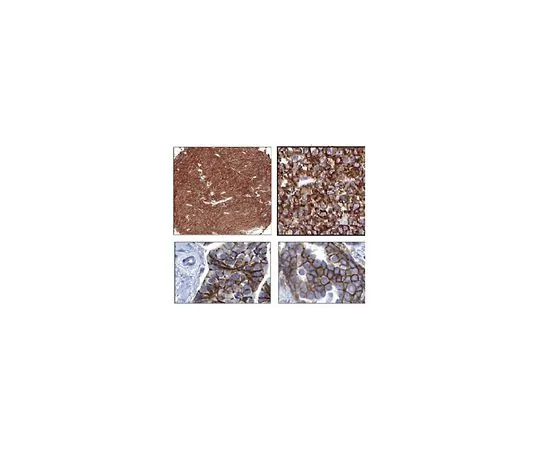 62-8523-87　Anti-ROR2 Antibody, clone Nt 2535-2835　MABS1152