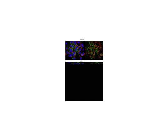 62-8472-55　Anti-WASH complex subunit FAM21C; 100 μg　ABT79