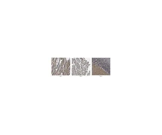 62-8473-13　Anti-Pro-neuregulin-1　ABT179