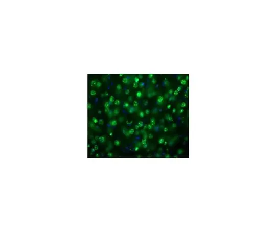 62-8468-83　Anti-MeCP2　ABN1728