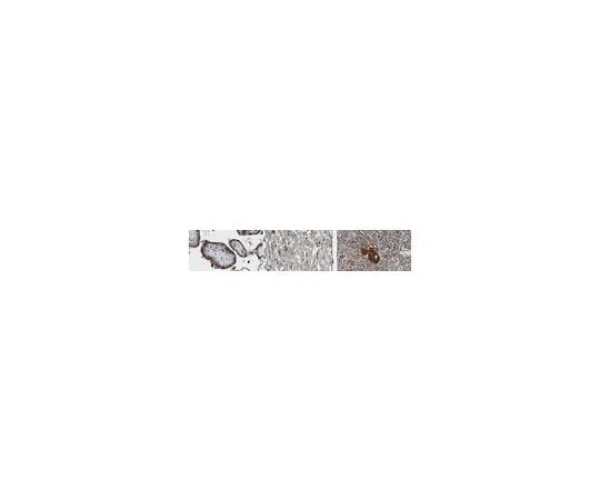 62-8521-36　Anti-TPP1 Antibody, clone 2E12　MABN1806