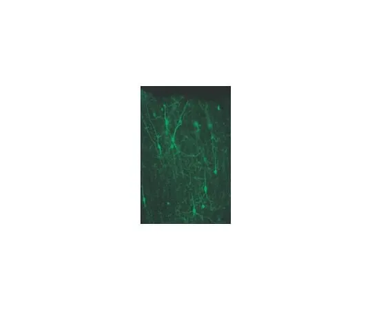62-8491-28　Anti-Calretinin, clone 6B8.2; 100 μg　MAB1568