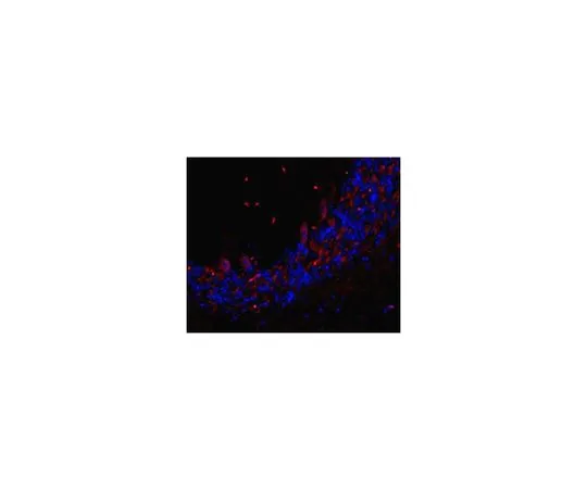 62-8517-95　Anti-TMEM106B Antibody, clone TME-N 6F2 Cat. No. MABN473　MABN473