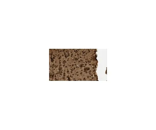 62-8519-49　Anti-Beta-glucosidase 2 (GBA2) Antibody, clone 4A12　MABN757