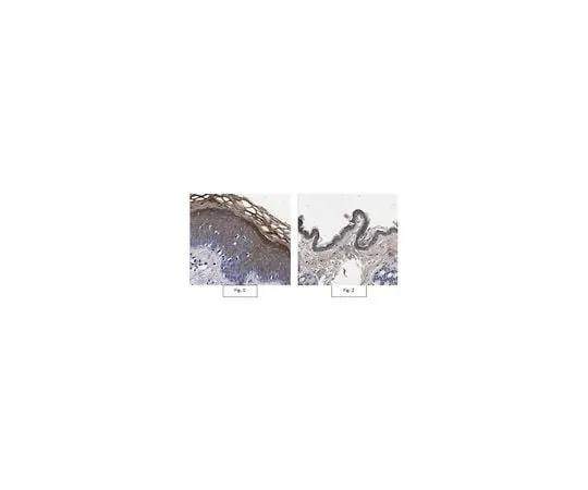 62-8473-37　Anti-Pro-Biglycan Antibody　ABT270