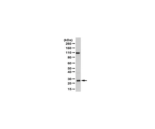 62-8473-05　Anti-RAB8A　ABT165